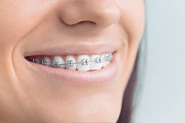 Best Wisdom Tooth Removal  in Hilton, NY
